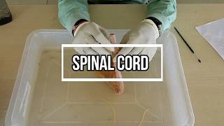 Spinal Cord - External Features screenshot 5