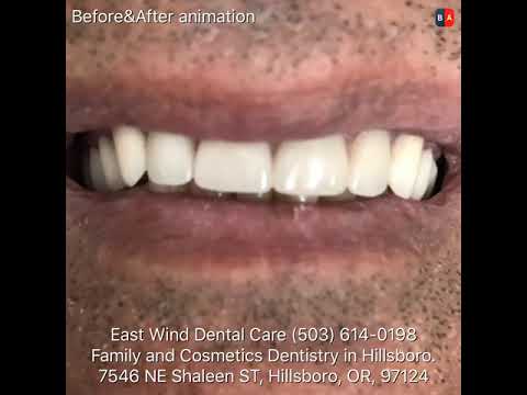 dentist's office by East Wind Dental Care Hillsboro Dentist