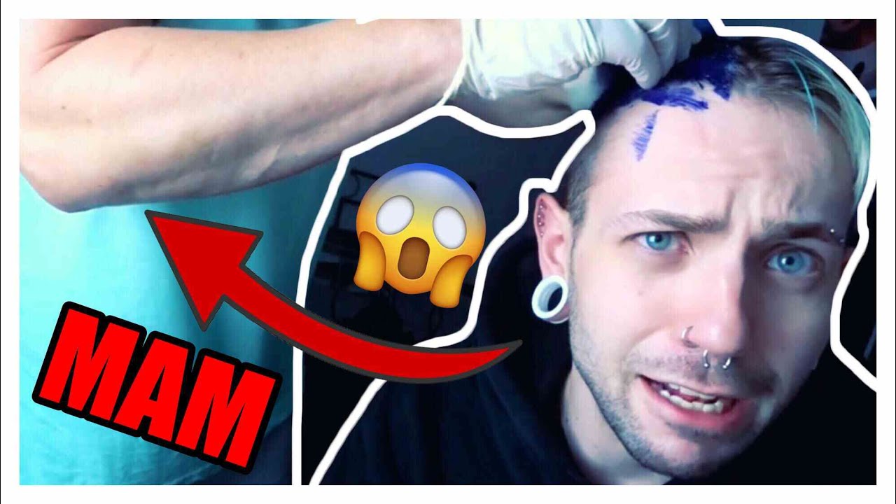 18+ Pickel Mit Hartem Kern Youtube Pics
