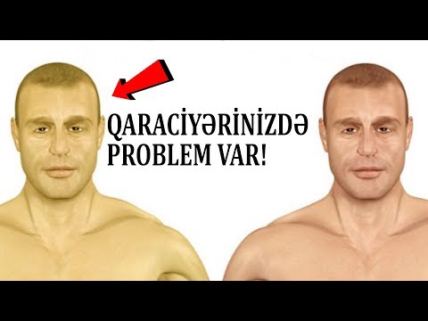 Video: Hansı əhali bölgüsü növü daha çox yayılmışdır?