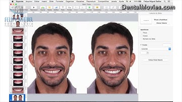 DSD   Digital Smile Design by Felipe Miguel