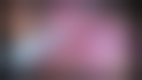 Laparoscopic Endoscopic Cooperative Surgery (LECS) for Gastric Antral Submucosal Tumour