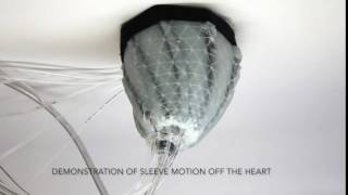 Demonstration of Sleeve Motion Off the Heart by Harvard Magazine 16,220 views 7 years ago 7 seconds