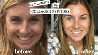 My Thoughts on Collagen Peptides + Benefits | Plus My Before and After