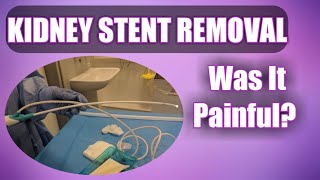 Kidney Stent Removal - Did It Hurt? (See Inside My Bladder!)