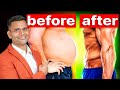 Fastest Way To Lose 10 Kg Weight at Home | How To Burn Body Fat - Dr. Vivek Joshi