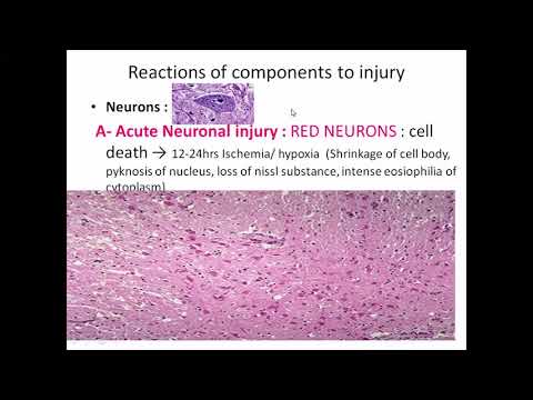 Lec. 1 | Pathology( Dr. Hiba) | Characteristic Features of CNS & Congenital Malformations