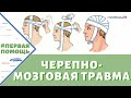 ЧТО ДЕЛАТЬ ПРИ ЧЕРЕПНО-МОЗГОВОЙ ТРАВМЕ