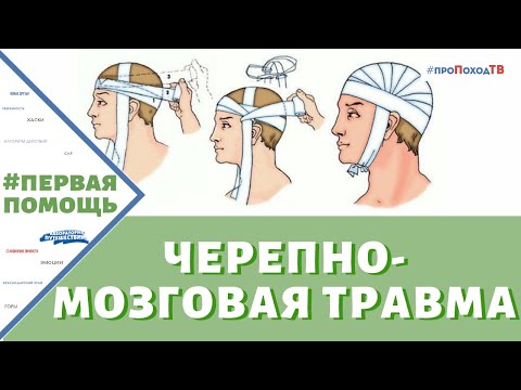 Видео: 3 простых способа лечения черепно-мозговой травмы