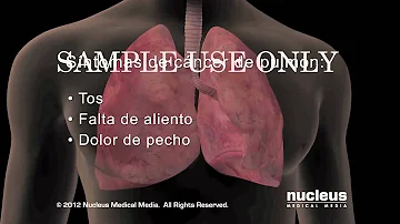 ¿Cómo empieza el cáncer de pulmón avanzado?