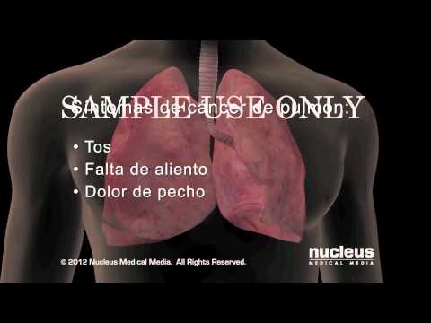 Video: ¿La asbestosis causa cáncer de pulmón?