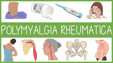 Polymyalgia Rheumatica Visually Explained