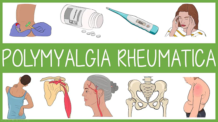 Polymyalgia Rheumatica Visually Explained