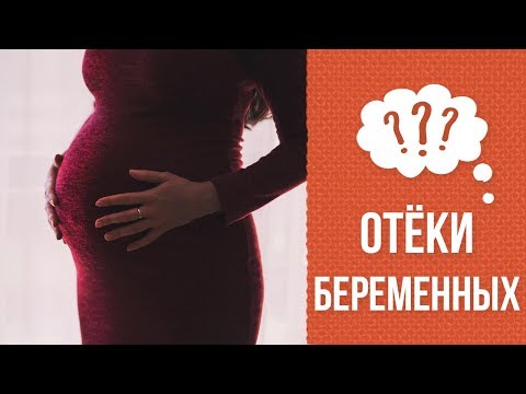 Почему возникают отеки при беременности
