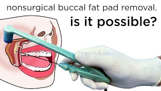 NONSURGICAL BUCCAL FAT REMOVAL | MINIMALLY INVASIVE | Is it possible? Safe? Dr. Zelken says NO WAY!