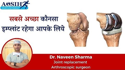 which implant company is best for knee replacement #TKR #jointreplacement #goldknee