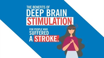 Deep Brain Stimulation is Promising for Stroke Patients, Study Shows