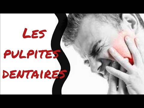 Vidéo: Pulpite Aiguë Et Chronique - Traitement, Symptômes