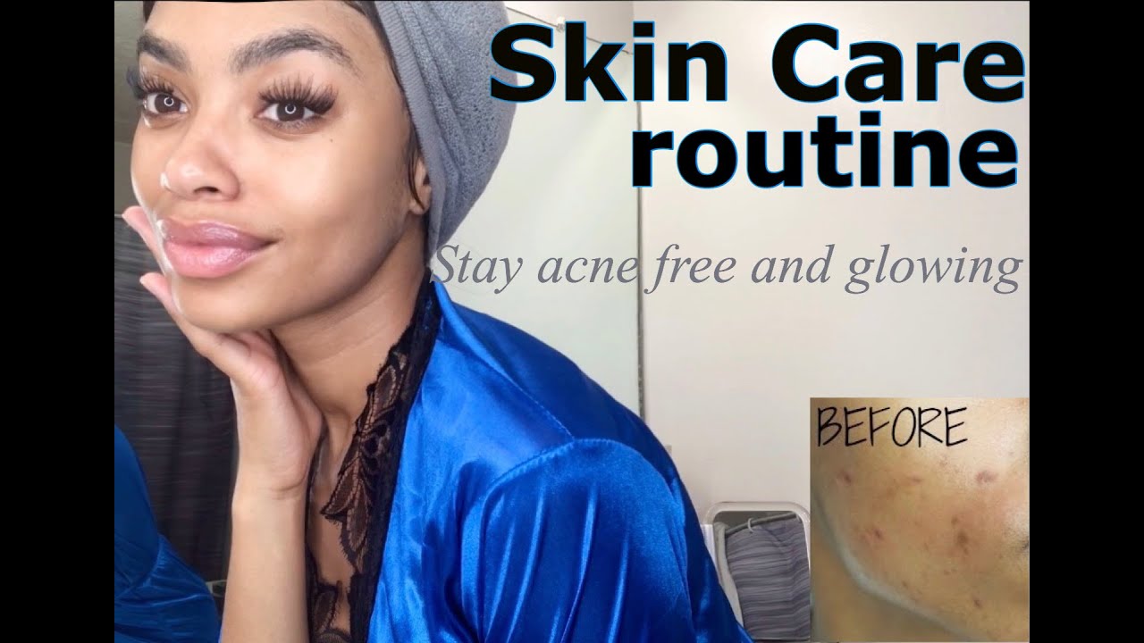 HOW TO FADE ACNE SCARS & GET CLEAR GLOWING SKIN | DO THIS AFFORDABLE