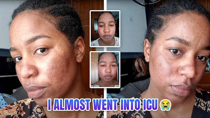 BEWARE OF WHAT THEY DON’T TELL YOU!!! THE DARK SIDE OF SKIN CARE PRODUCTS ⚠️ || DIANA BAHATI