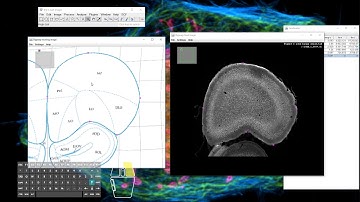 [Obsolete] Big Warp Atlas Alignment Demo