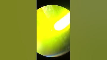 pascal laser with Eye2Mobile