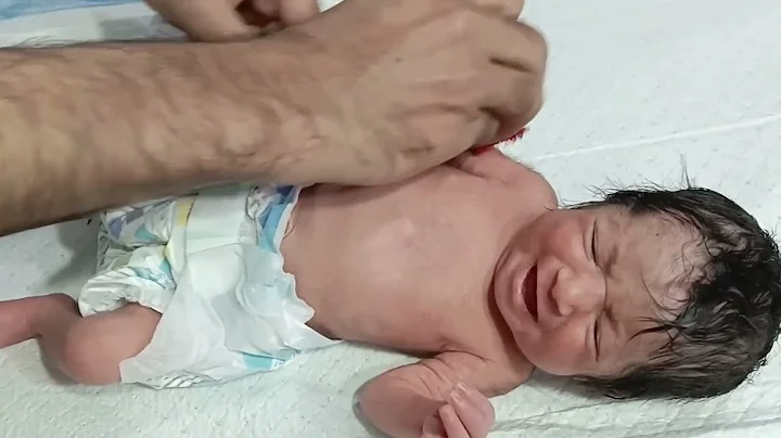 I.V Cannulation in a Neonate | Baby Boy 💕 Step-by-Step 🐥 | NICU Nursing Care