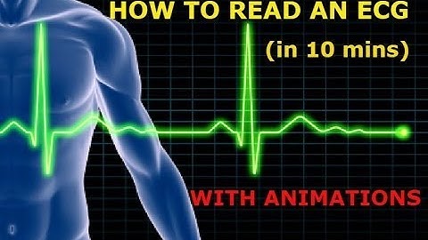 HOW TO READ AN ECG!! WITH ANIMATIONS (in 10 mins)!