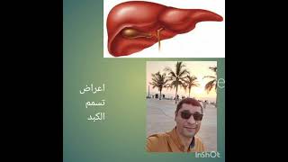 اعراض تسمم الكبد