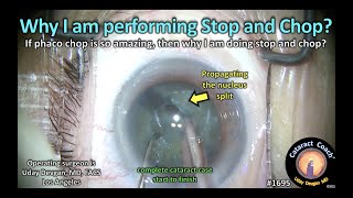 CataractCoach™ 1695: why am I performing stop and chop?