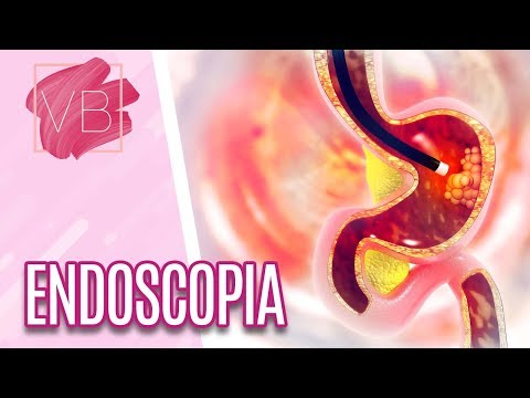 Vídeo: Endoscopia - Métodos, Tipos, Indicações, Como O Estudo é Realizado