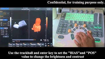 Color Doppler Ultrasound Chison Q5 | 4D Video Training Volumetric Probe