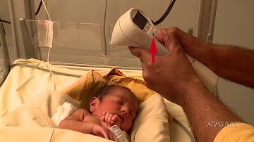 How to measure transcutaneous bilirubinTcB?