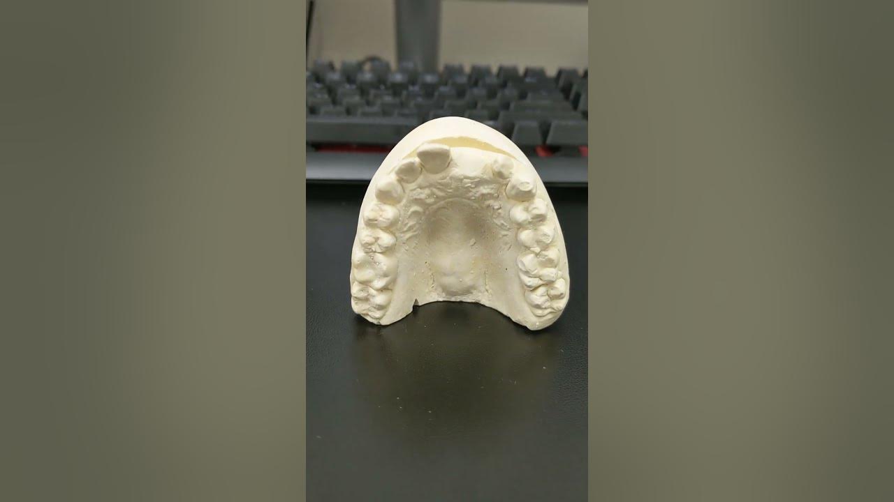 demonstration on how to put in a flipper tooth YouTube