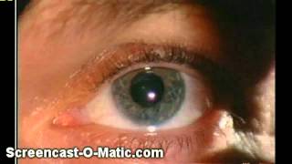 Blindsight - Seeing Without Awareness
