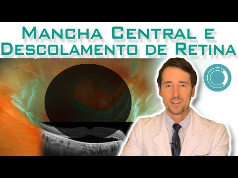 Mancha no centro