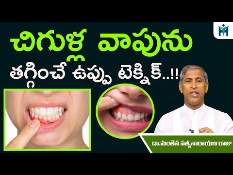 చిగుళ్ల వాపు, నొప్పిని తగ్గించే బెస్ట్ ఉప్పు టెక్నిక్ | Manthena Satyanarayana Raju | Health Mantra|