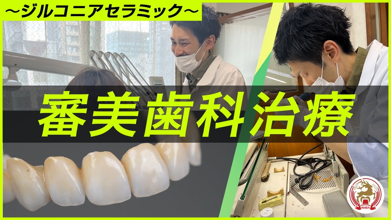 歯科審美学 製品詳細「ルートZX3」 | フォルディネット