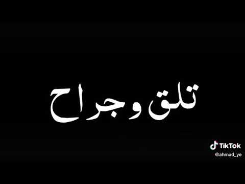 عارف ايه الي دار تاني