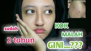 RIVIEW 10HARI SETELAH BERHENTI PAKAI NU AMOOREA