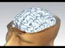 MRI Scan of Human Head