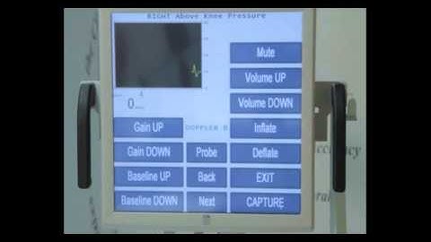 Segmental Pressure Study PVR Waveforms