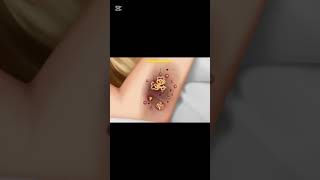 You Won’t Believe This Armpit Cleaning! 🤯 #asmr #asmrshorts #doctor  #foryou #asmrroleplay #relaxing