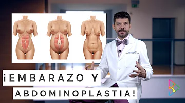 ¿Por qué no se pueden tener hijos después de una abdominoplastia?