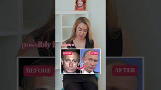 What cosmetic procedures has Putin had? 🤔💉 #trulydental #dentist #putin #botox #filler What cosmetic procedures has Putin had? 🤔💉 #trulydental #dentist #putin #botox #filler