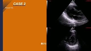 SAEM23: 2023 E/M Changes and How They Impact POCUS