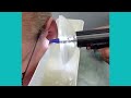 EPIC Irrigation Wax Removal with Dr. Angela Lasecki