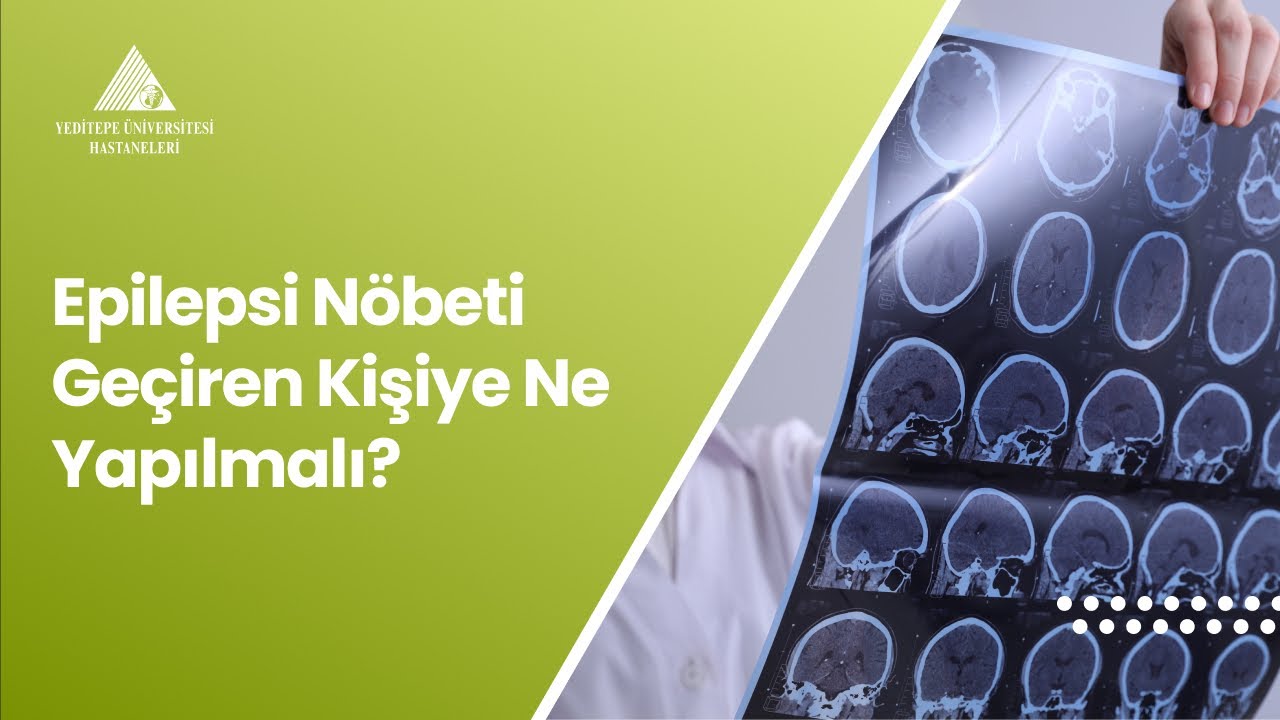 Epilepsi nöbeti geçiren kişiye nasıl davranılmalı Epilepsi nöbeti geçiren kişiye nasıl davranılmalı