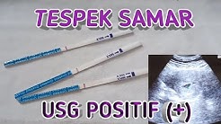 TESPEK SAMAR HASIL USG POSITIF (+) - Durasi: 5.18. TESPEK SAMAR HASIL USG POSITIF (+) - Durasi: 5.18.