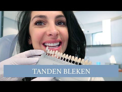 VLOG: TANDEN BLEKEN - Anna Nooshin